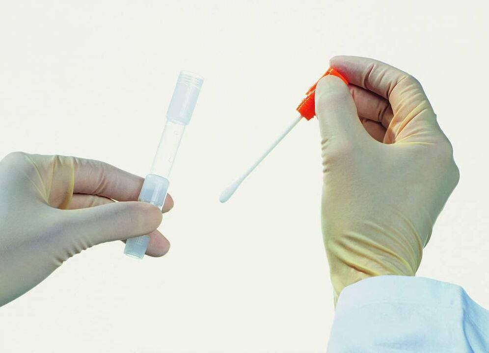 Analysis collection for the detection of chronic prostatitis