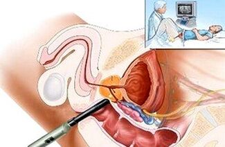 Possibilities for the diagnosis of prostatitis